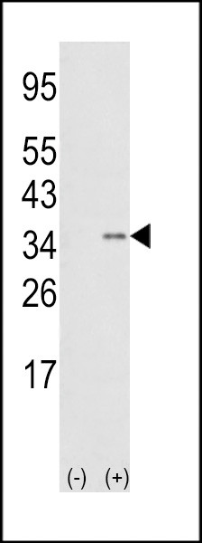 SNAIL Antibody in Western Blot (WB)