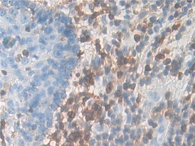 CD127 Antibody in Immunohistochemistry (Paraffin) (IHC (P))