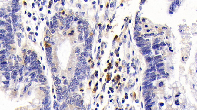 CD127 Antibody in Immunohistochemistry (Paraffin) (IHC (P))