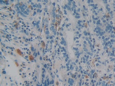 IBA1 Antibody in Immunohistochemistry (Paraffin) (IHC (P))