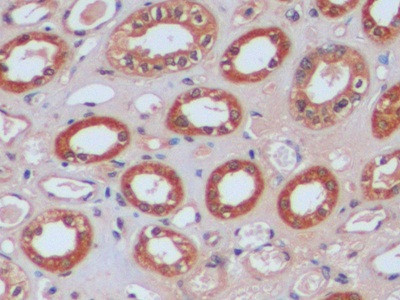 IDH1 Antibody in Immunohistochemistry (Paraffin) (IHC (P))