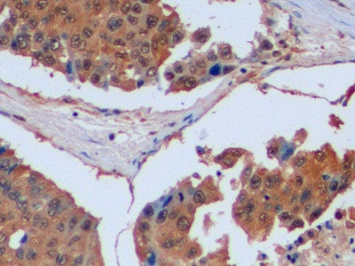 IDH1 Antibody in Immunohistochemistry (Paraffin) (IHC (P))