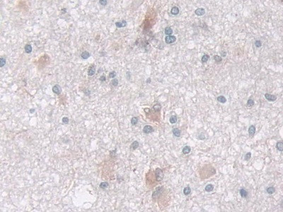 IDH2 Antibody in Immunohistochemistry (Paraffin) (IHC (P))