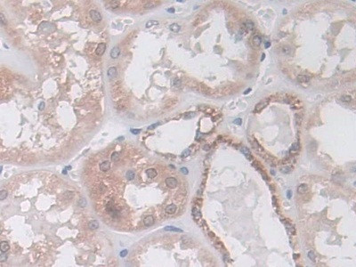 IDH2 Antibody in Immunohistochemistry (Paraffin) (IHC (P))