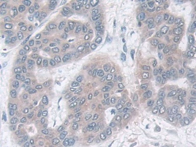 IDH2 Antibody in Immunohistochemistry (Paraffin) (IHC (P))