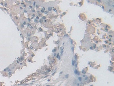 IDH2 Antibody in Immunohistochemistry (Paraffin) (IHC (P))