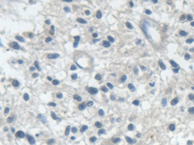 IARS Antibody in Immunohistochemistry (Paraffin) (IHC (P))