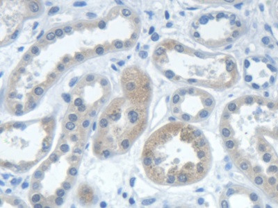 IARS Antibody in Immunohistochemistry (Paraffin) (IHC (P))