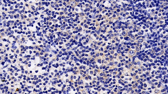 JAK2 Antibody in Immunohistochemistry (Paraffin) (IHC (P))