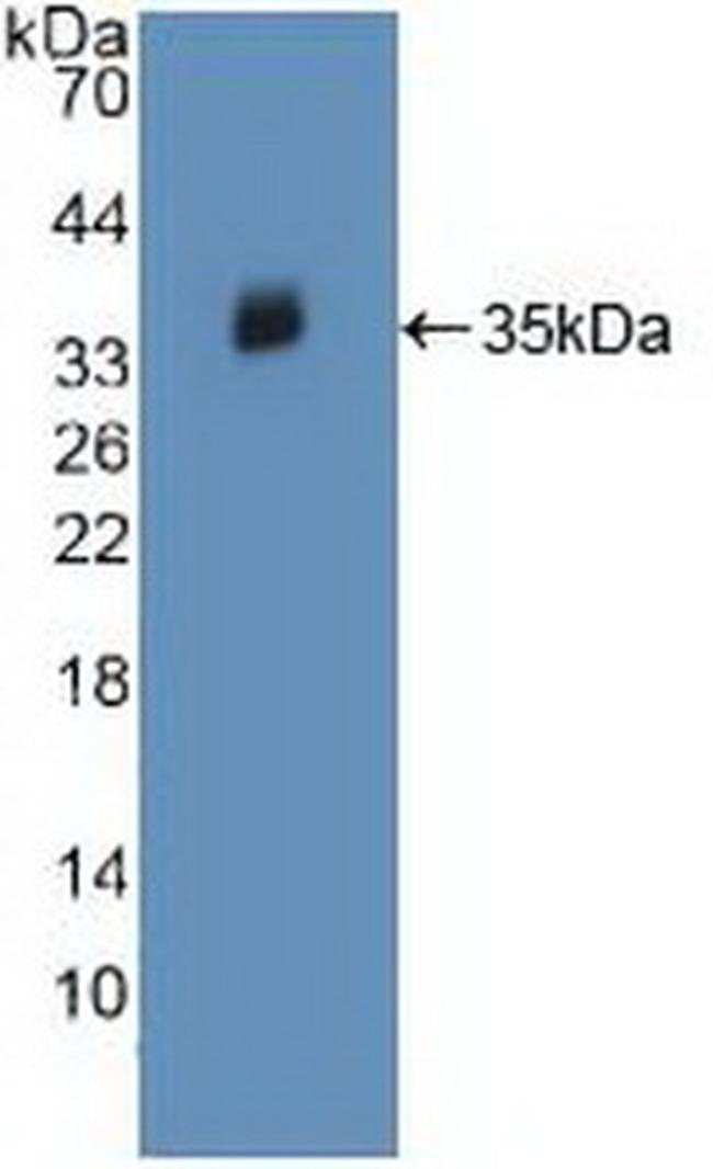 JAK2 Antibody in Western Blot (WB)