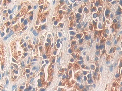 KLK11 Antibody in Immunohistochemistry (Paraffin) (IHC (P))