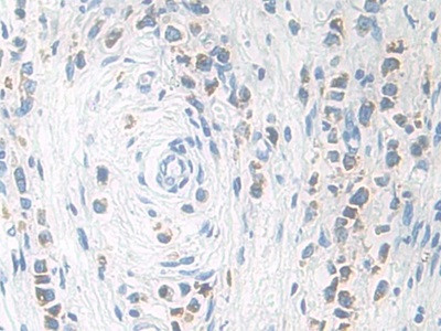 KLK11 Antibody in Immunohistochemistry (Paraffin) (IHC (P))