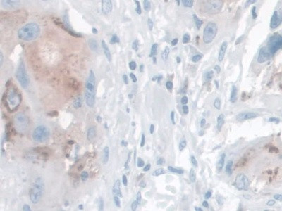 Kallikrein 14 Antibody in Immunohistochemistry (Paraffin) (IHC (P))