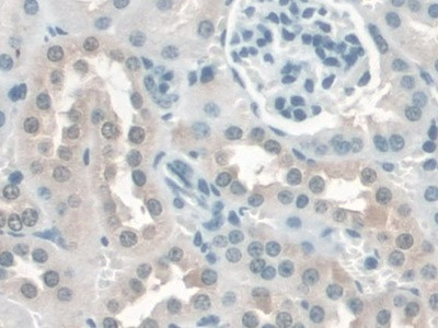 KATNA1 Antibody in Immunohistochemistry (Paraffin) (IHC (P))