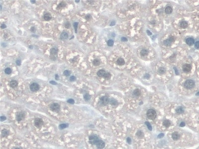 KATNA1 Antibody in Immunohistochemistry (Paraffin) (IHC (P))