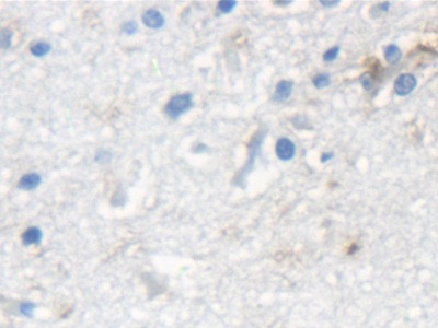 KRT33A Antibody in Immunohistochemistry (Paraffin) (IHC (P))