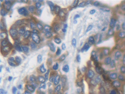 KRT33A Antibody in Immunohistochemistry (Paraffin) (IHC (P))