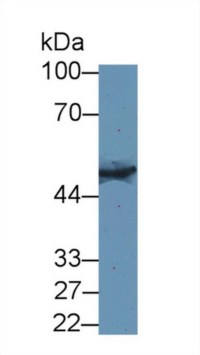 KRT33A Antibody in Western Blot (WB)