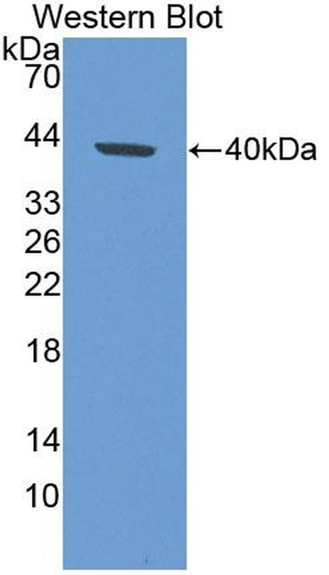 KRT33A Antibody in Western Blot (WB)