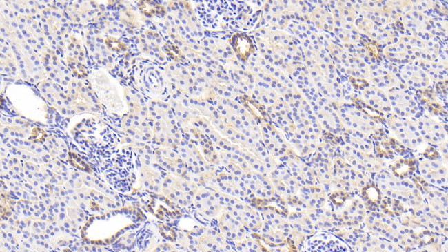 LDHB Antibody in Immunohistochemistry (Paraffin) (IHC (P))