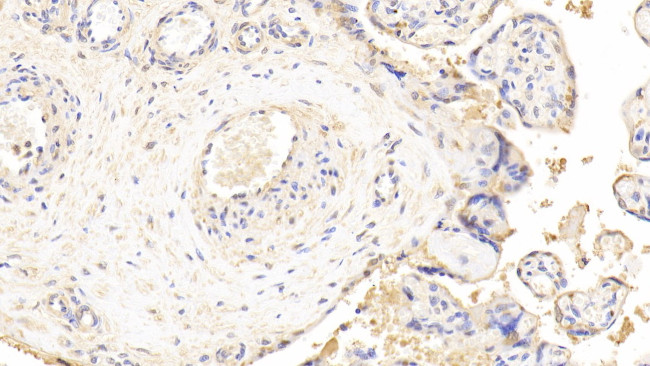 LDHB Antibody in Immunohistochemistry (Paraffin) (IHC (P))