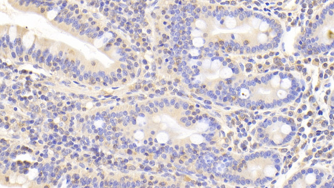 LDHB Antibody in Immunohistochemistry (Paraffin) (IHC (P))