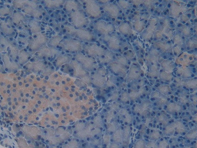 Laminin alpha-1 Antibody in Immunohistochemistry (Paraffin) (IHC (P))