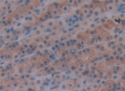 Laminin alpha-1 Antibody in Immunohistochemistry (Paraffin) (IHC (P))