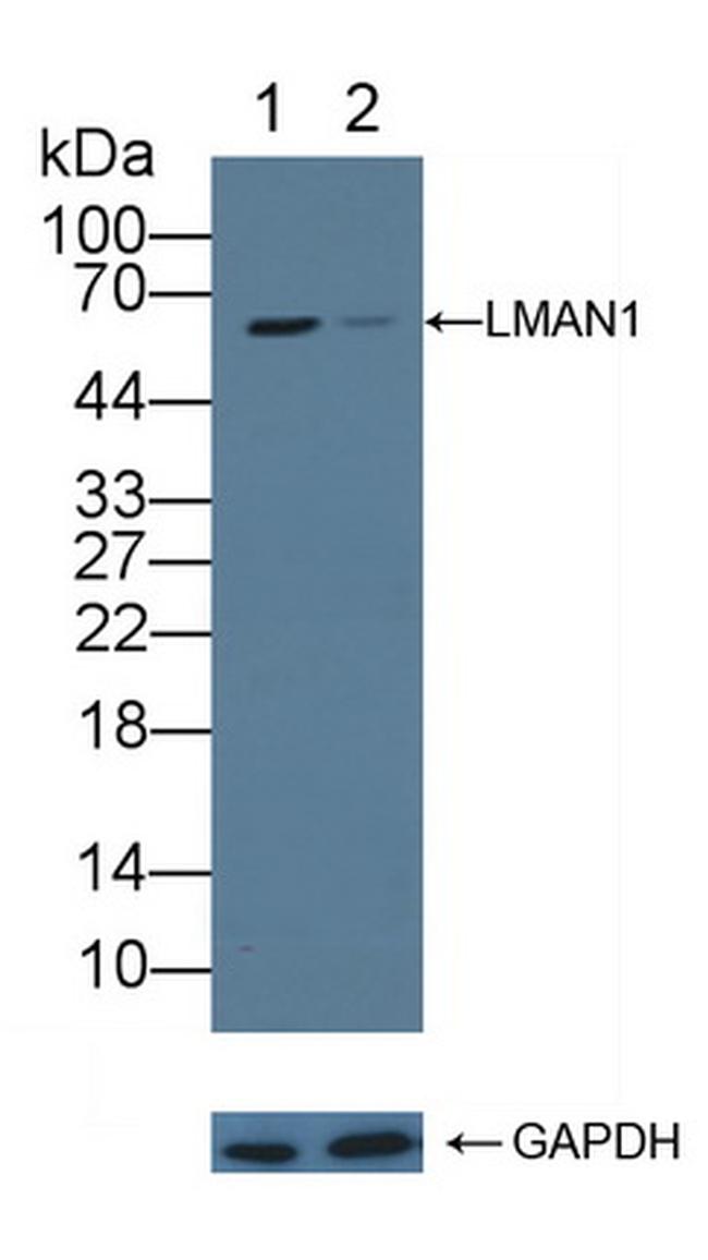 LMAN1 Antibody in Western Blot (WB)