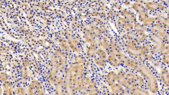 LEPR Antibody in Immunohistochemistry (Paraffin) (IHC (P))