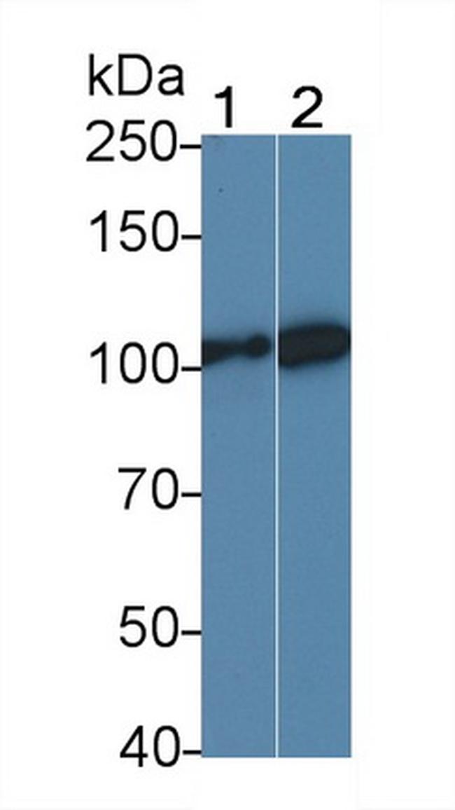 LEPR Antibody in Western Blot (WB)