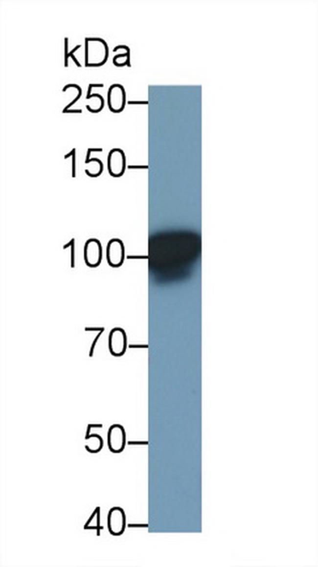 LEPR Antibody in Western Blot (WB)