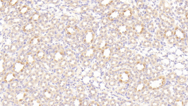 LEPR Antibody in Immunohistochemistry (Paraffin) (IHC (P))