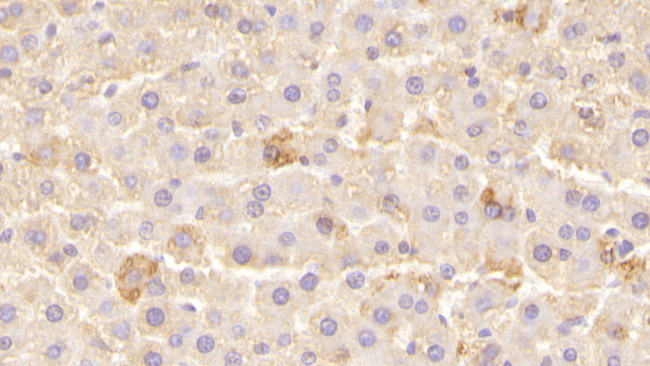 LEPR Antibody in Immunohistochemistry (Paraffin) (IHC (P))