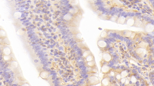 LEPR Antibody in Immunohistochemistry (Paraffin) (IHC (P))