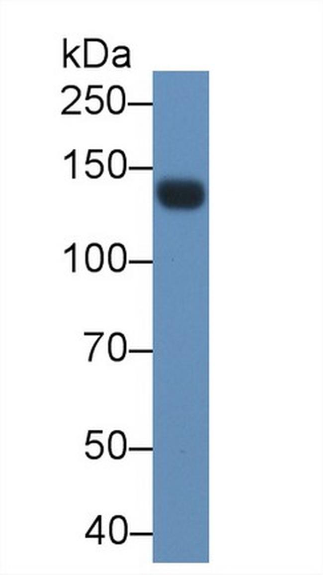 LEPR Antibody in Western Blot (WB)