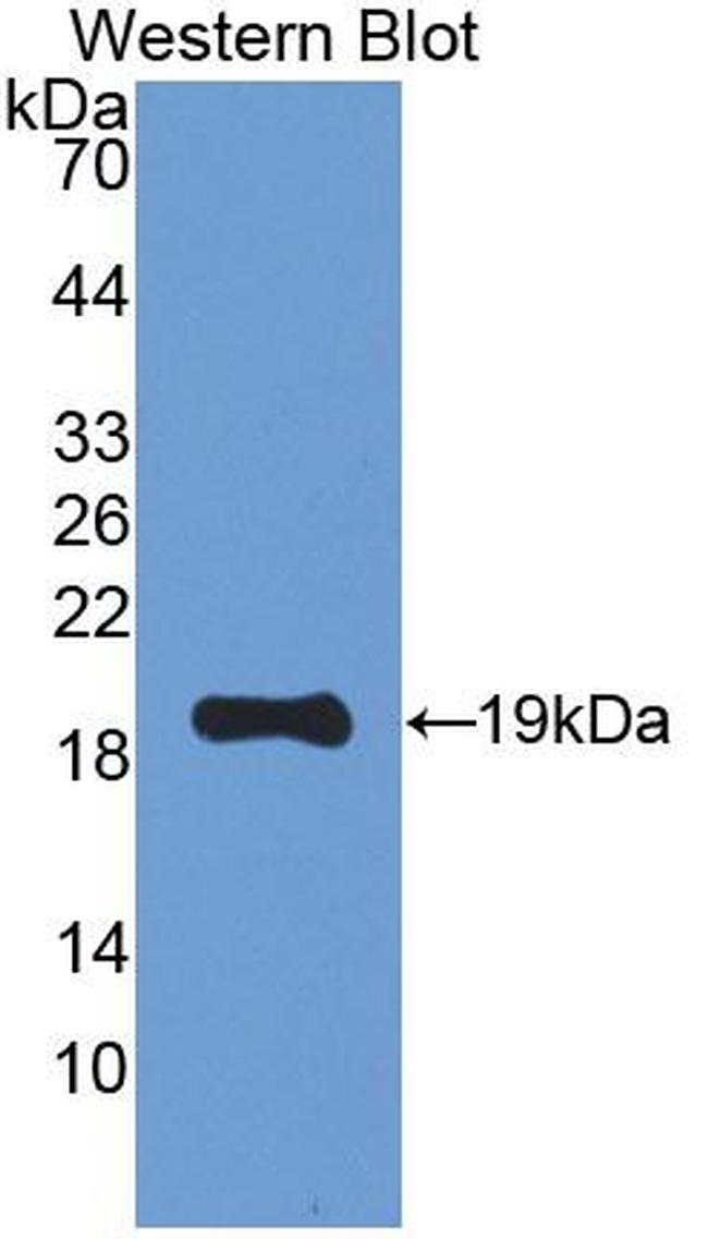 LEPR Antibody in Western Blot (WB)