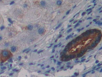 LSR Antibody in Immunohistochemistry (Paraffin) (IHC (P))