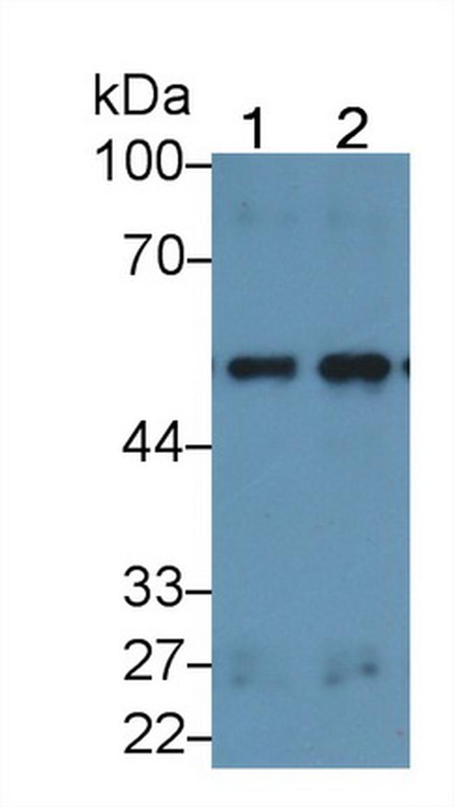 LSR Antibody in Western Blot (WB)