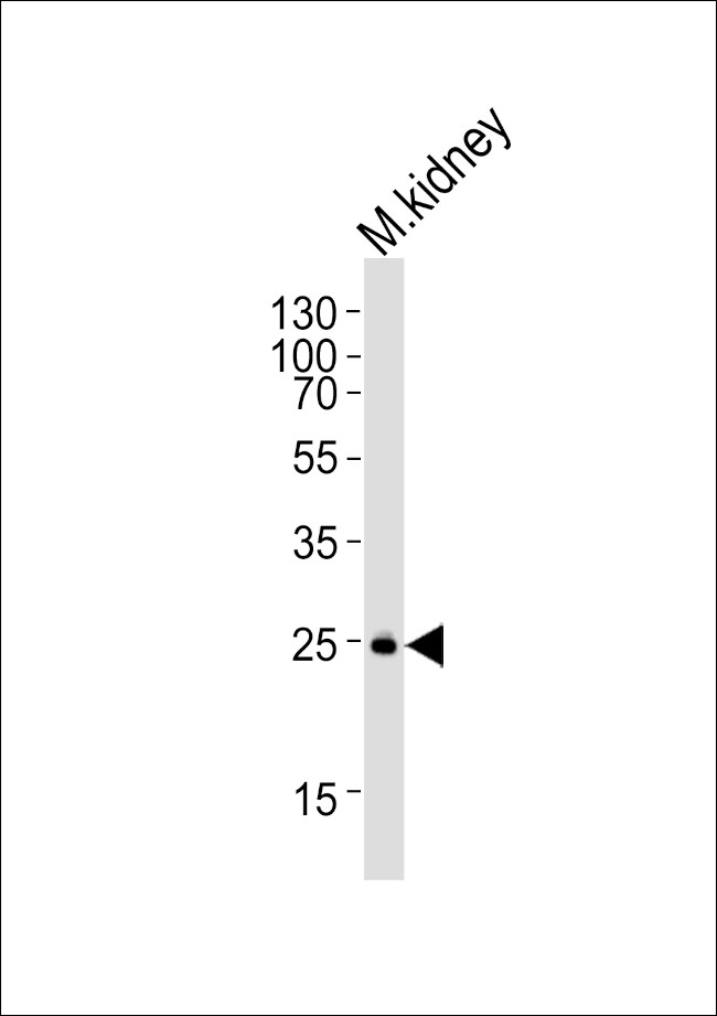 SNAIL Antibody in Western Blot (WB)