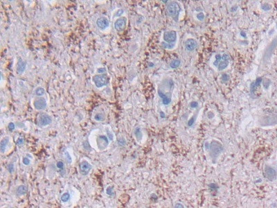 TDH Antibody in Immunohistochemistry (Paraffin) (IHC (P))