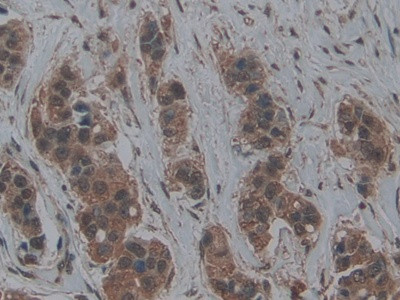 LTBR Antibody in Immunohistochemistry (Paraffin) (IHC (P))