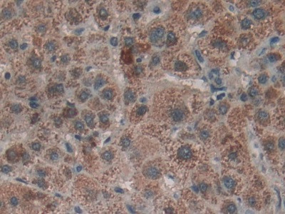 LTBR Antibody in Immunohistochemistry (Paraffin) (IHC (P))