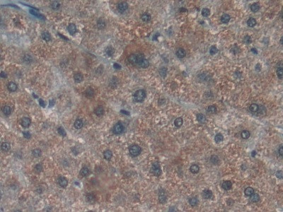 LTBR Antibody in Immunohistochemistry (Paraffin) (IHC (P))