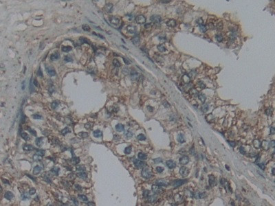 LTBR Antibody in Immunohistochemistry (Paraffin) (IHC (P))