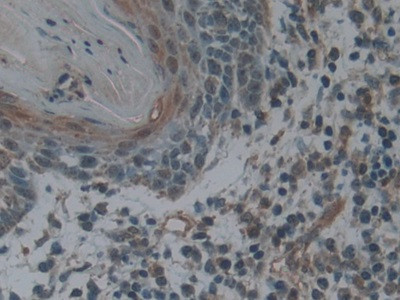 LTBR Antibody in Immunohistochemistry (Paraffin) (IHC (P))