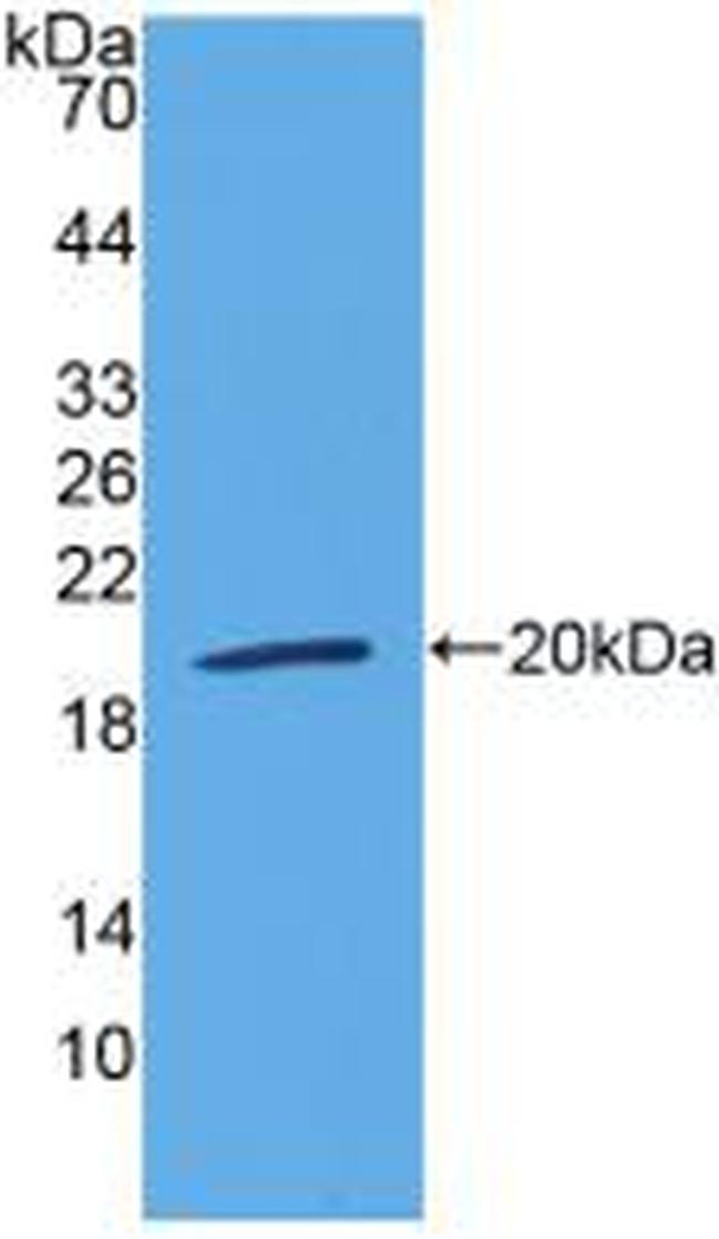 LTBR Antibody in Western Blot (WB)