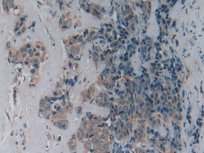 LPCAT3 Antibody in Immunohistochemistry (Paraffin) (IHC (P))