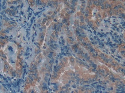 LPCAT3 Antibody in Immunohistochemistry (Paraffin) (IHC (P))