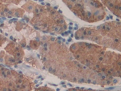 KARS Antibody in Immunohistochemistry (Paraffin) (IHC (P))